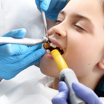 Bellevue Kids Dentist - Young child getting their tooth worked on